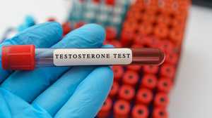 Quels est le taux de testostérone normal chez l’homme ?