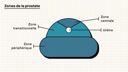 schéma zones de la prostate