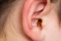 comment-savoir-si-on-a-un-bouchon-oreille