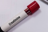 creatinine-a-jeun