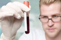 quest-ce-que-le-cholesterol-ldl