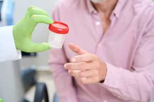 Créatinine urinaire : taux normal et causes d’un taux trop haut