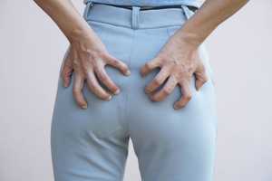 Anus qui gratte : causes, traitements et remèdes naturels