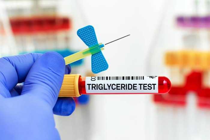 Triglycérides : définition, les faire baisser et taux normal