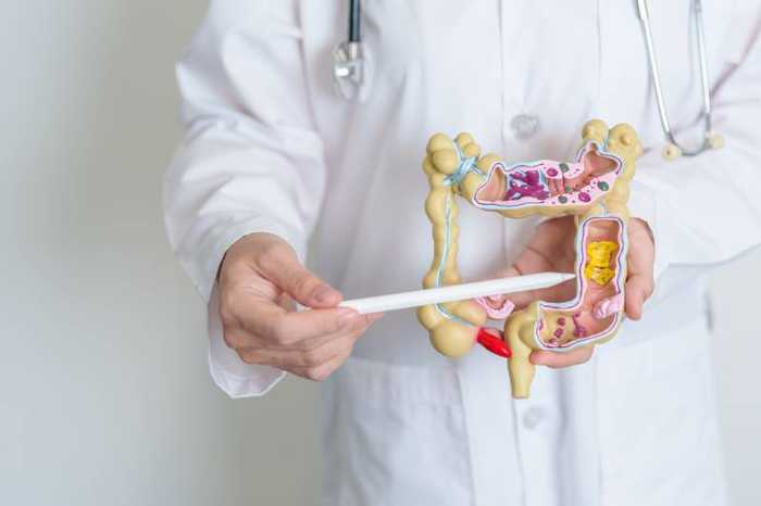 Maladie de Crohn : symptômes, traitement, diagnostic et causes