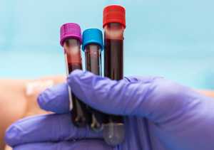 Lipase élevée : symptômes, causes et solutions